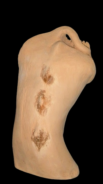 skin1-d